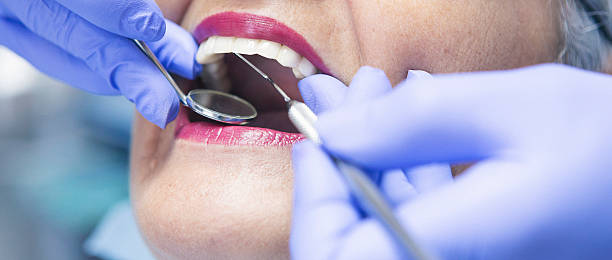 Best Emergency Dentist for Lost Fillings or Crowns in Kendall Park, NJ